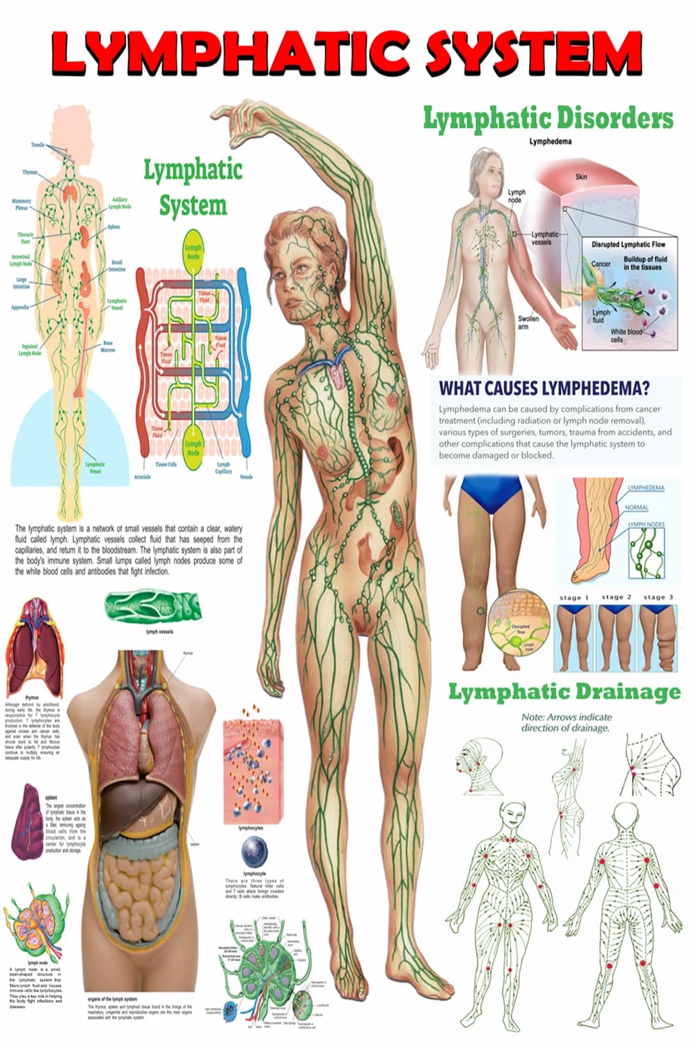 Lymphatic system poster main view with anatomy, lymphedema stages, and drainage map