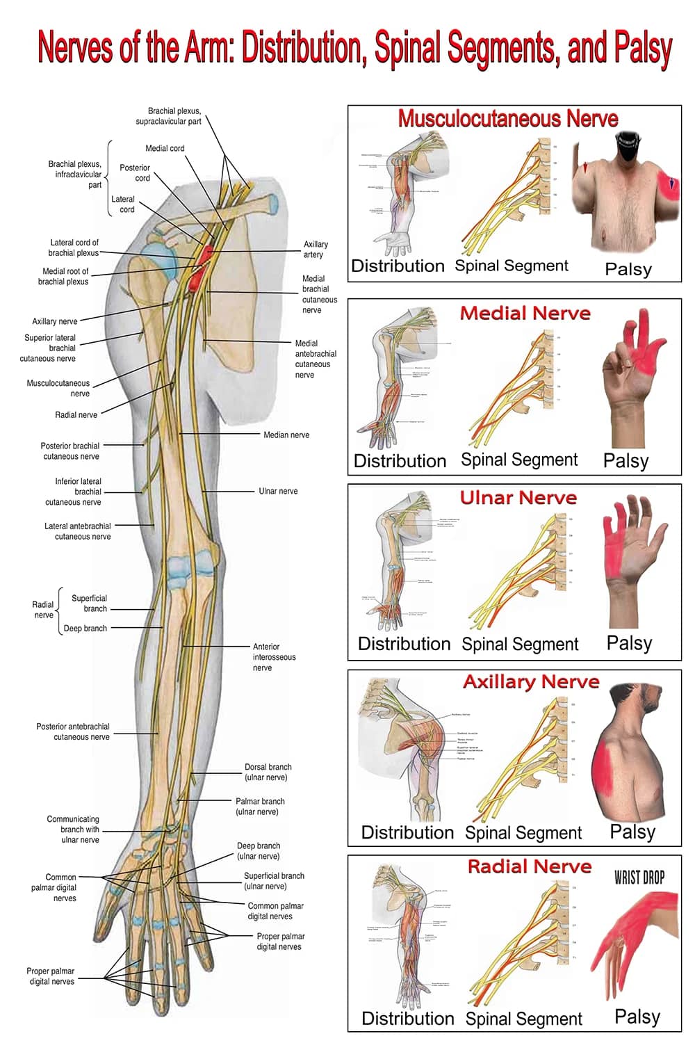 Poster showing nerves of the arm with brachial plexus, nerve distribution, and palsy patterns
