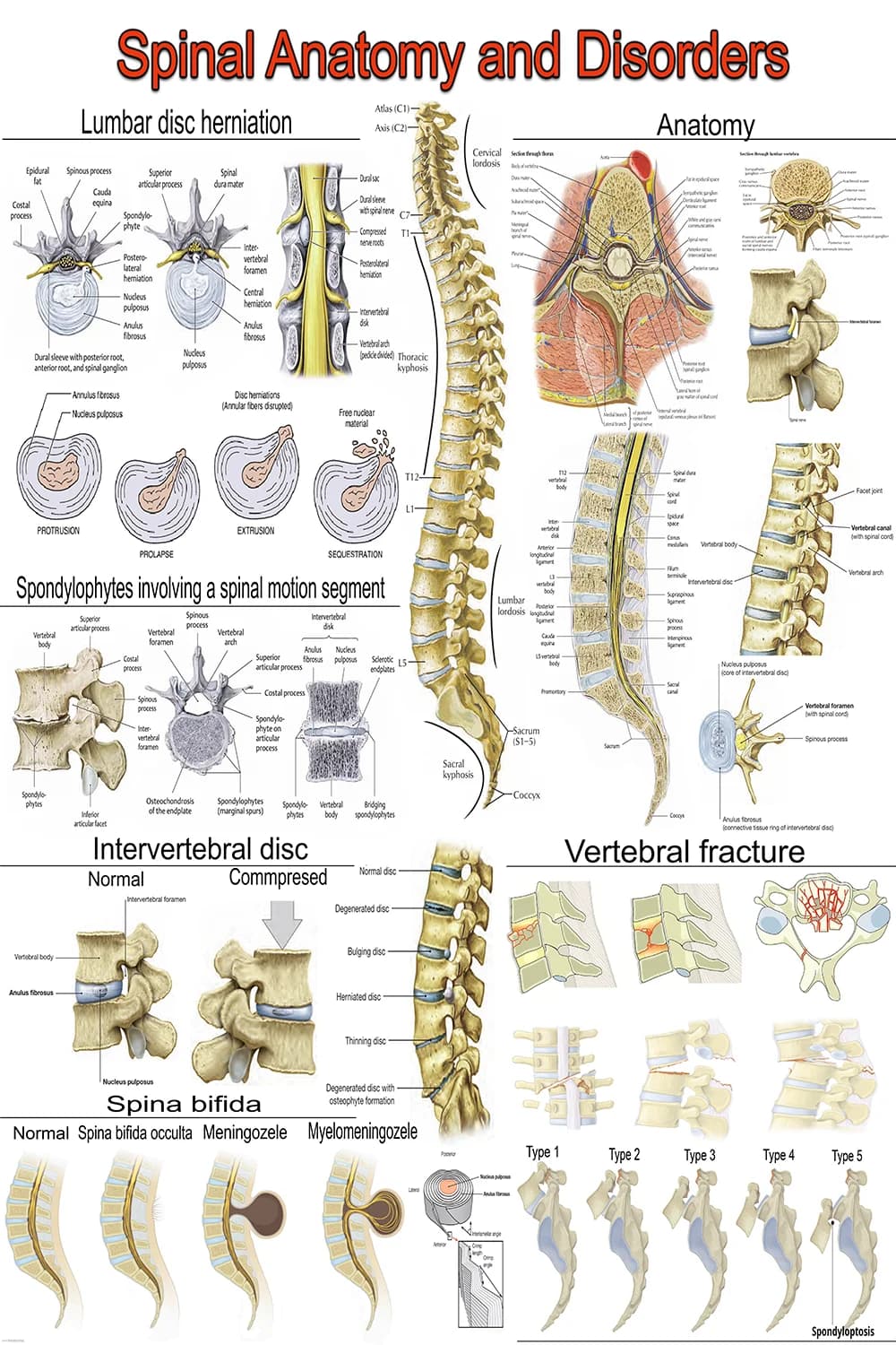 Spinal Anatomy And Disorders anatomical poster main view